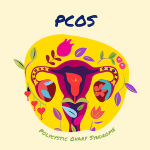 Polycystic Ovary Syndrome PCOS, illustration of a uterus
